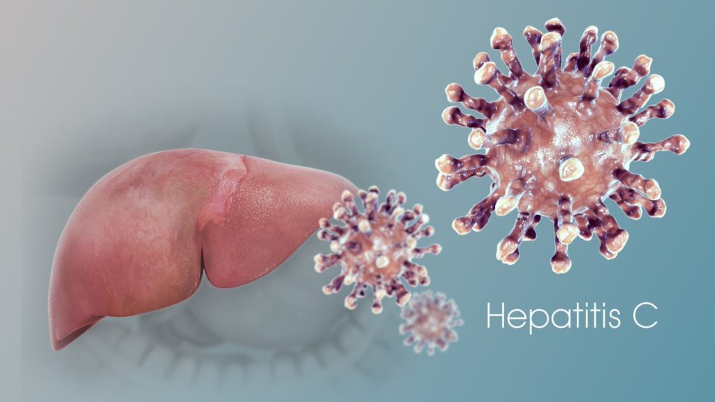 Последствия и осложнения вирусной болезни после лечения гепатита с