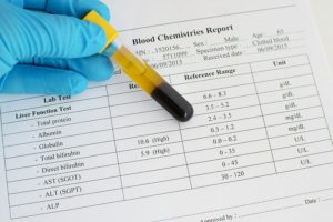 Биохимический анализ крови норма АЛТ и АСТ